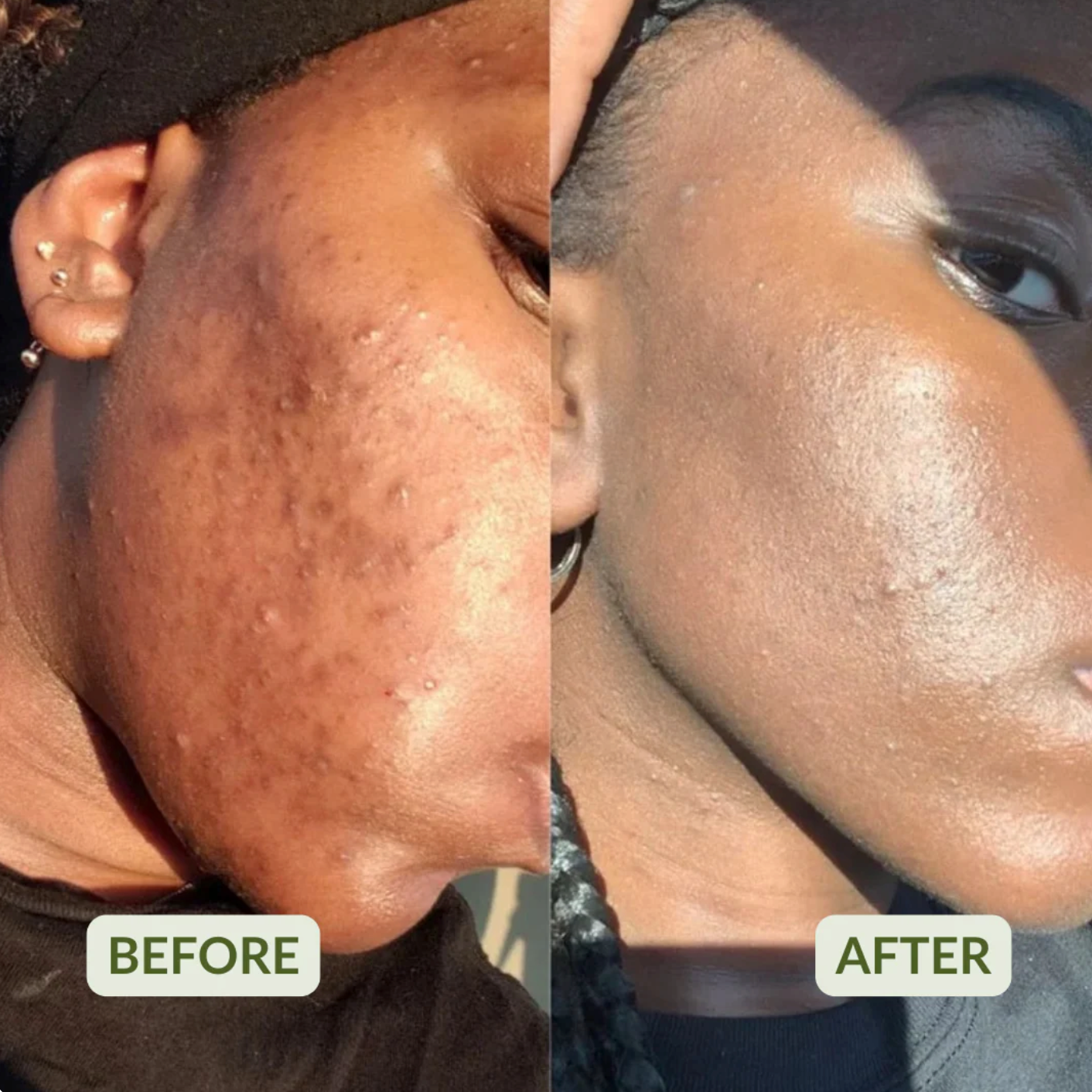 Korean Toner Pads
